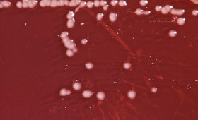 Учёные назвали бактериальное средство от серой гнили в честь Киану Ривза