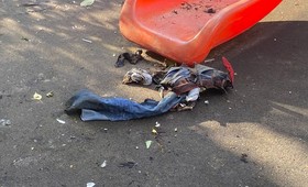 Стало известно о состоянии мальчика, которого облили бензином и подожгли на площадке в Москве