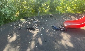 Московский школьник получил ожог 80% тела, играя с бензином во дворе
